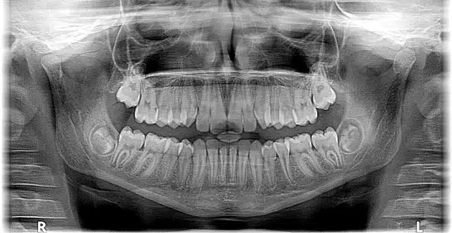 Cosmetic Dentistry