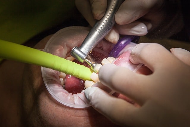 Oral Cancer and What You Probably Dont Know