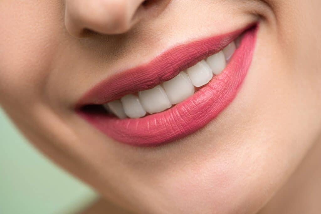 Professional Teeth Whitening for Dazzling Results